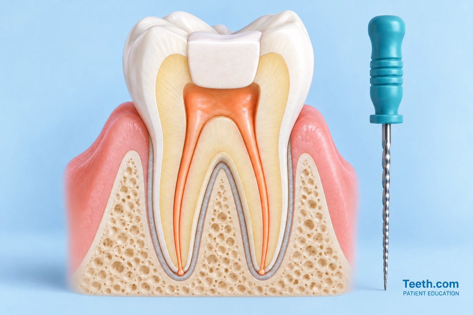 Simplified cutaway showing the inside of a tooth and its root canals